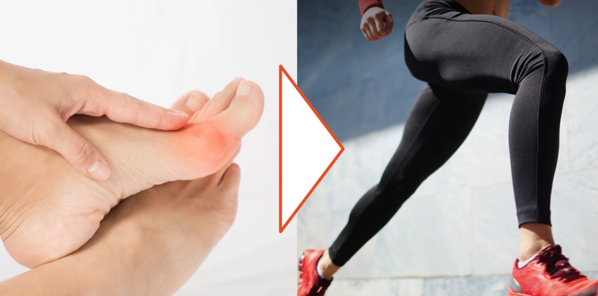 Von Hallux-Schmerz zu voller Beweglichkeit